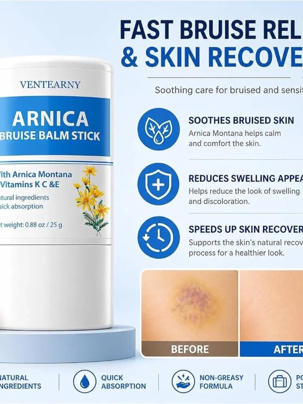 Ventearny Arnica Bruise Balm Stick